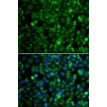 Immunofluorescence - Anti-TMLHE Antibody (A7312) - Antibodies.com