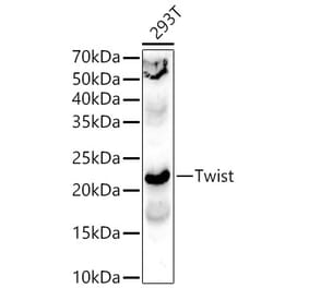 Western Blot - Anti-Twist Antibody (A15639) - Antibodies.com