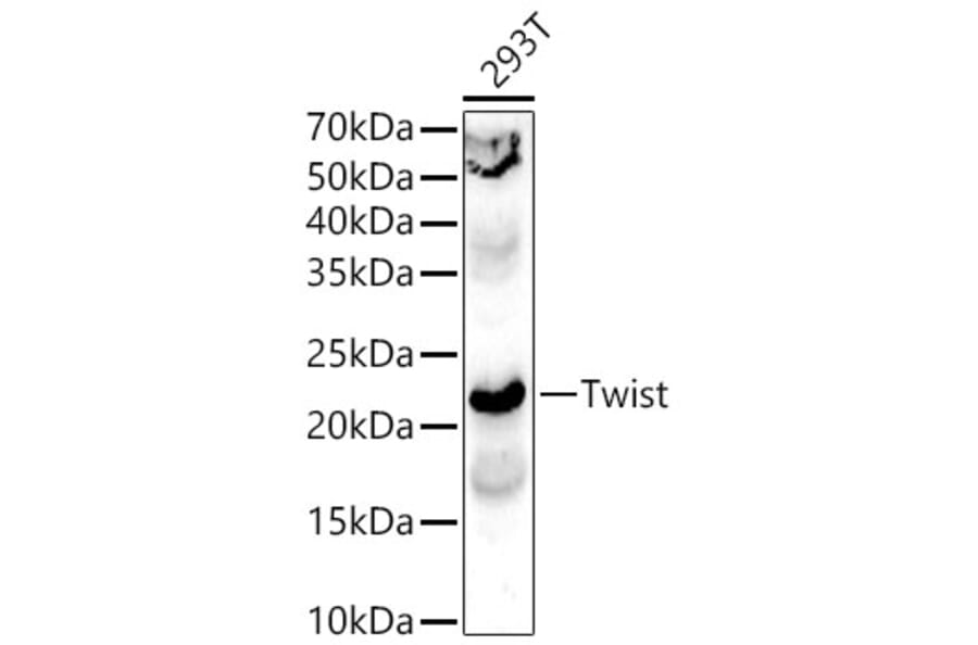 Western Blot - Anti-Twist Antibody (A15639) - Antibodies.com