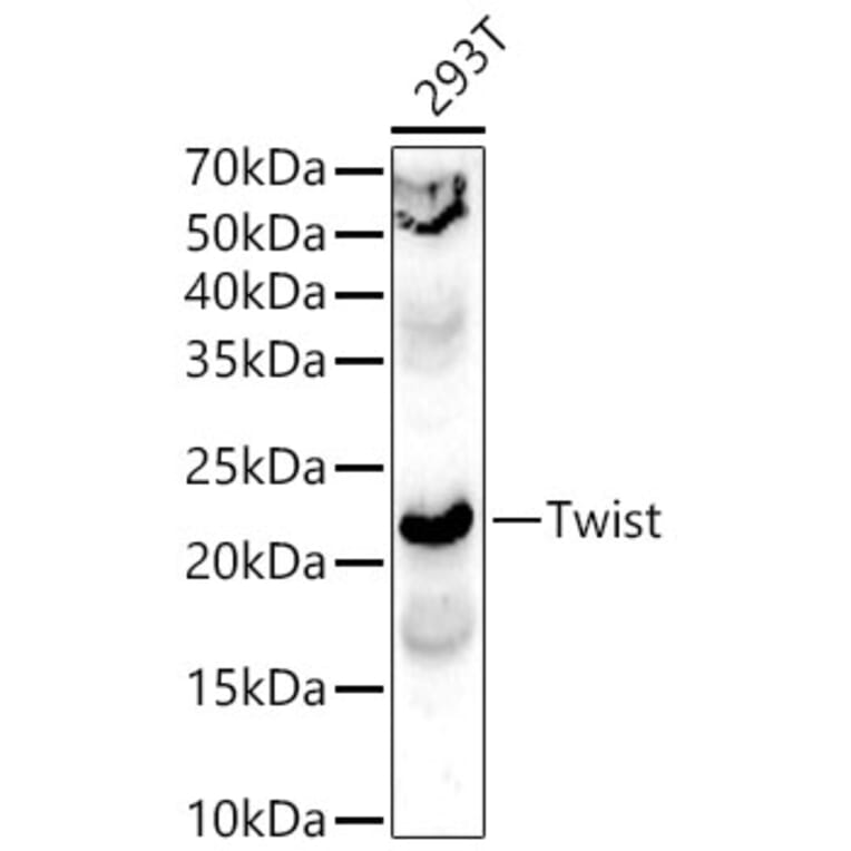 Western Blot - Anti-Twist Antibody (A15639) - Antibodies.com