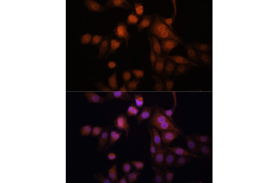 Immunofluorescence - Anti-Twist Antibody (A15639) - Antibodies.com
