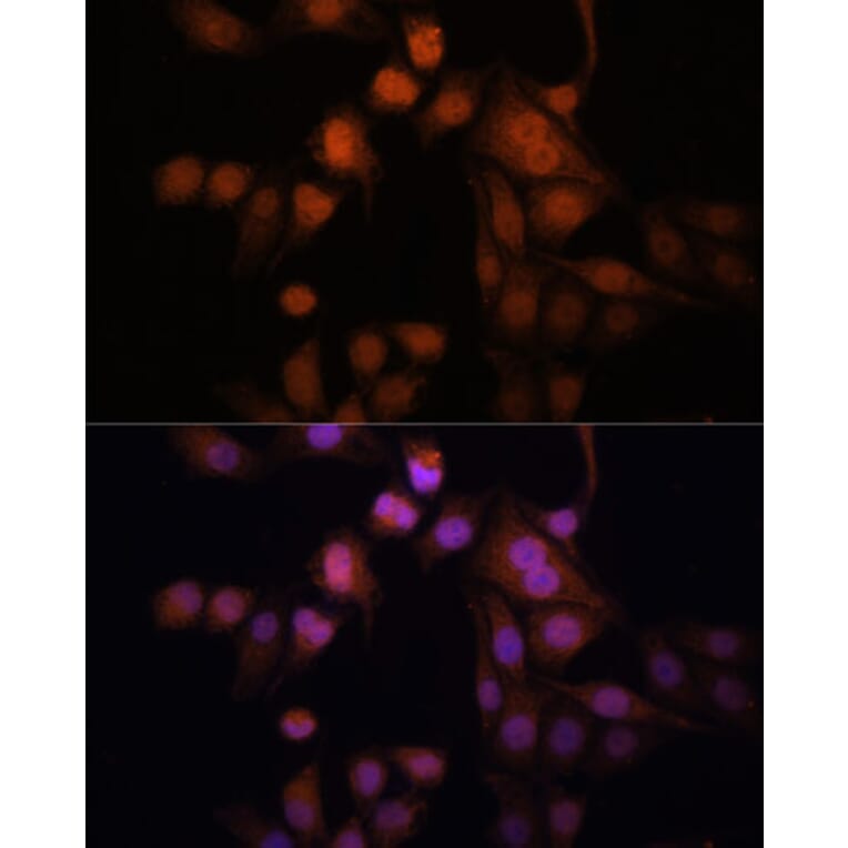 Immunofluorescence - Anti-Twist Antibody (A15639) - Antibodies.com