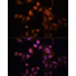 Immunofluorescence - Anti-Twist Antibody (A15639) - Antibodies.com