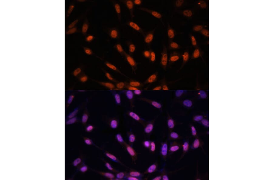 Immunofluorescence - Anti-Twist Antibody (A15639) - Antibodies.com