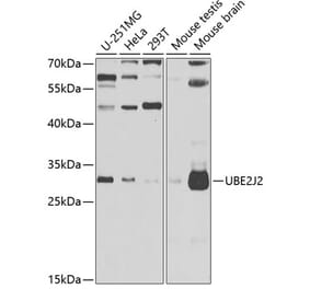 Western Blot - Anti-UBE2J2 Antibody (A15640) - Antibodies.com