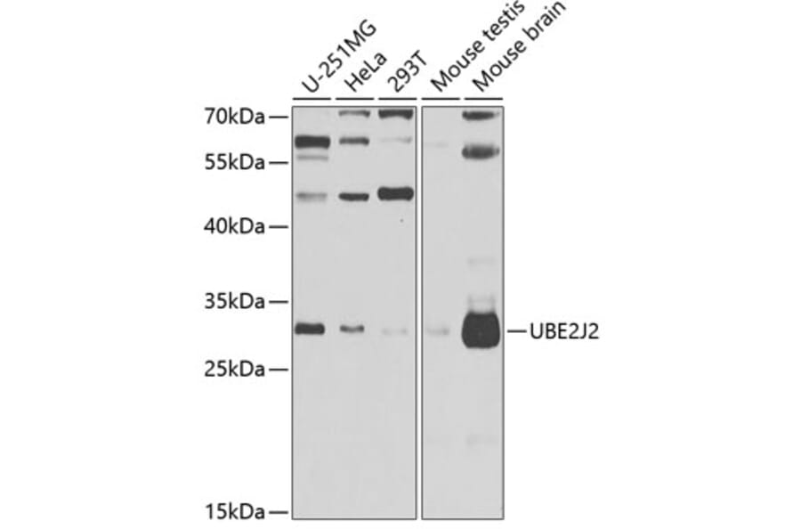 Western Blot - Anti-UBE2J2 Antibody (A15640) - Antibodies.com