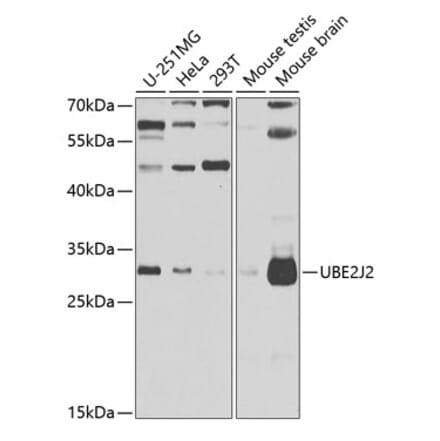 Western Blot - Anti-UBE2J2 Antibody (A15640) - Antibodies.com