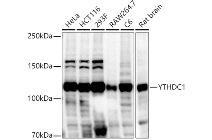 Western Blot - Anti-YTHDC1 Antibody (A15641) - Antibodies.com