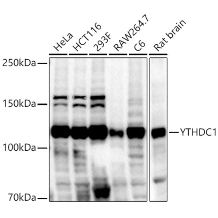 Western Blot - Anti-YTHDC1 Antibody (A15641) - Antibodies.com