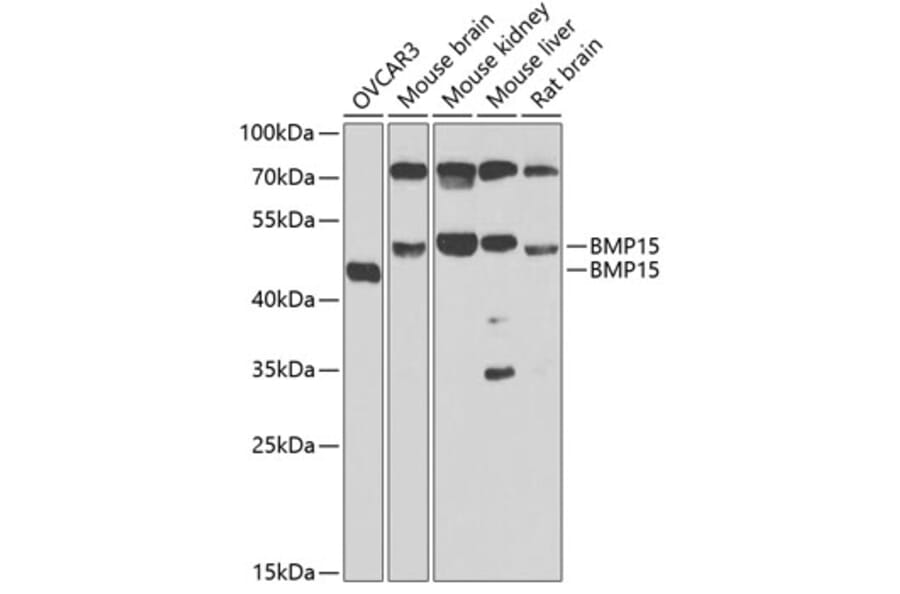 Western Blot - Anti-BMP15 Antibody (A15642) - Antibodies.com