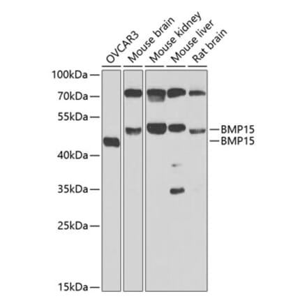 Western Blot - Anti-BMP15 Antibody (A15642) - Antibodies.com