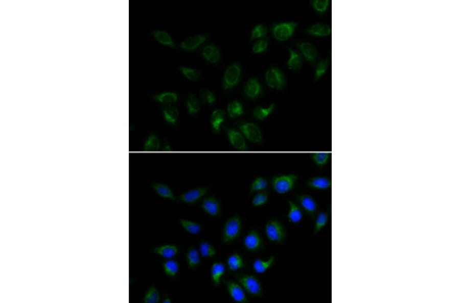 Immunofluorescence - Anti-BMP15 Antibody (A15642) - Antibodies.com