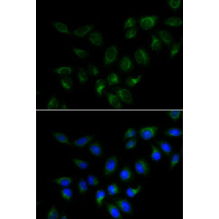 Immunofluorescence - Anti-BMP15 Antibody (A15642) - Antibodies.com