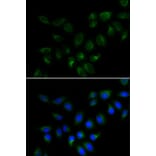 Immunofluorescence - Anti-BMP15 Antibody (A15642) - Antibodies.com