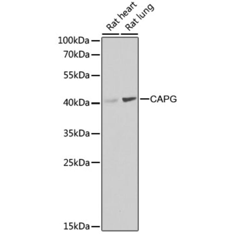 Western Blot - Anti-Actin Regulatory Protein CAPG / MCP Antibody (A15644) - Antibodies.com