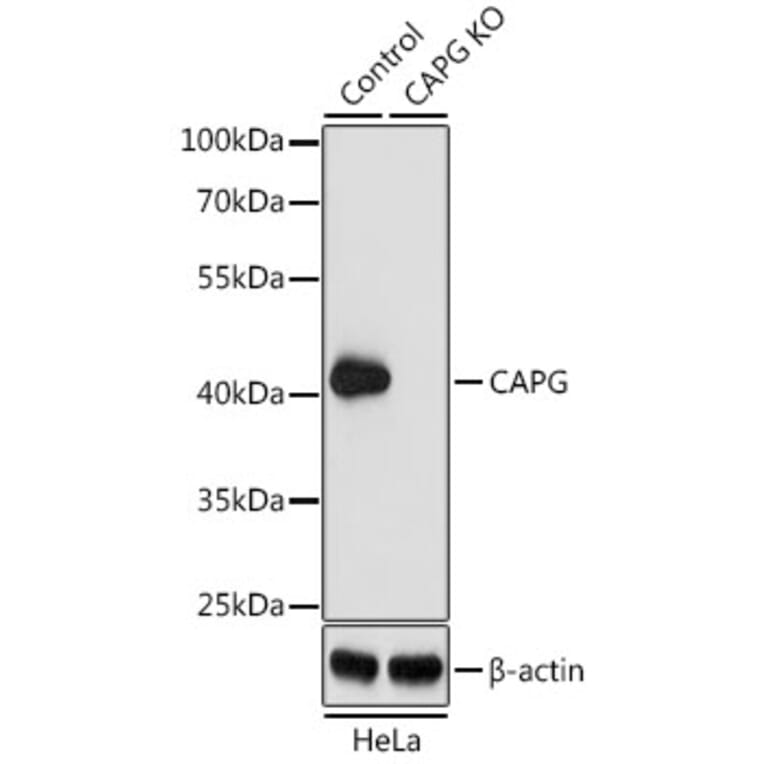 Western Blot - Anti-Actin Regulatory Protein CAPG / MCP Antibody (A15644) - Antibodies.com