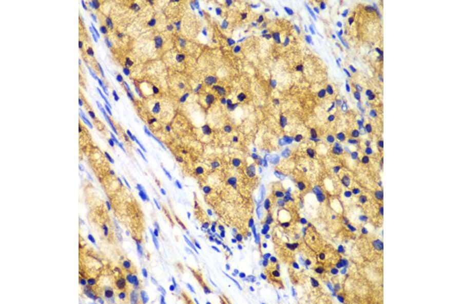 Immunohistochemistry - Anti-Actin Regulatory Protein CAPG/MCP Antibody (A15644) - Antibodies.com
