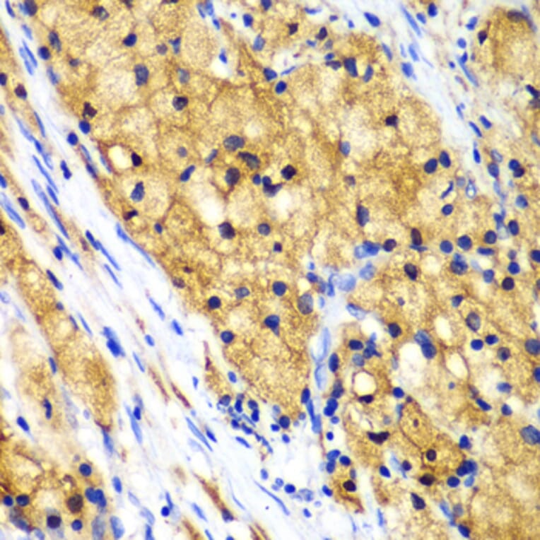 Immunohistochemistry - Anti-Actin Regulatory Protein CAPG / MCP Antibody (A15644) - Antibodies.com