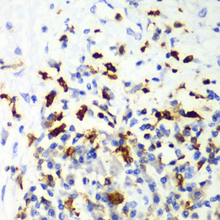 Immunohistochemistry - Anti-Actin Regulatory Protein CAPG / MCP Antibody (A15644) - Antibodies.com