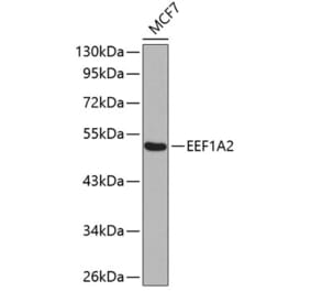 Western Blot - Anti-EEF1A2 Antibody (A15645) - Antibodies.com