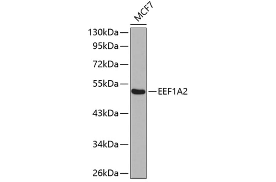 Western Blot - Anti-EEF1A2 Antibody (A15645) - Antibodies.com