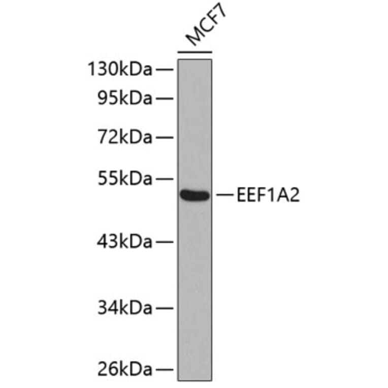 Western Blot - Anti-EEF1A2 Antibody (A15645) - Antibodies.com