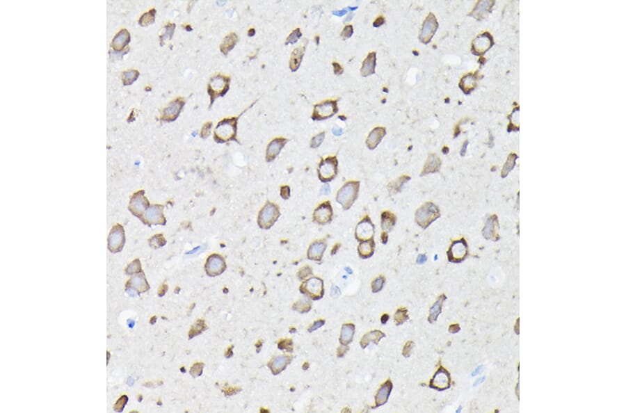 Immunohistochemistry - Anti-EEF1A2 Antibody (A15645) - Antibodies.com