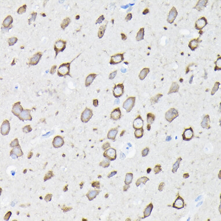 Immunohistochemistry - Anti-EEF1A2 Antibody (A15645) - Antibodies.com