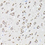Immunohistochemistry - Anti-EEF1A2 Antibody (A15645) - Antibodies.com