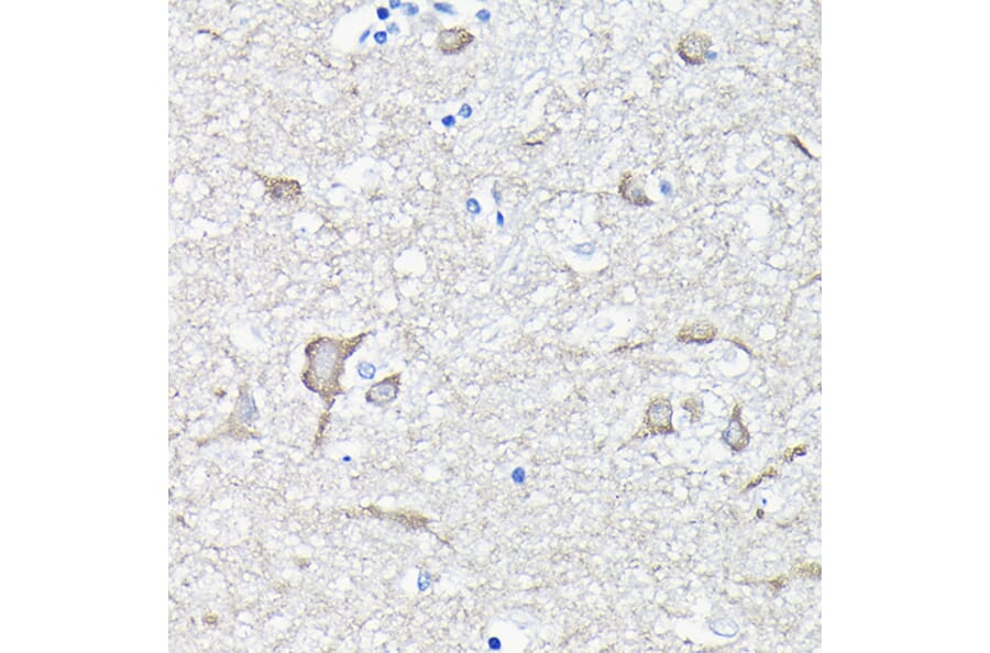 Immunohistochemistry - Anti-EEF1A2 Antibody (A15645) - Antibodies.com