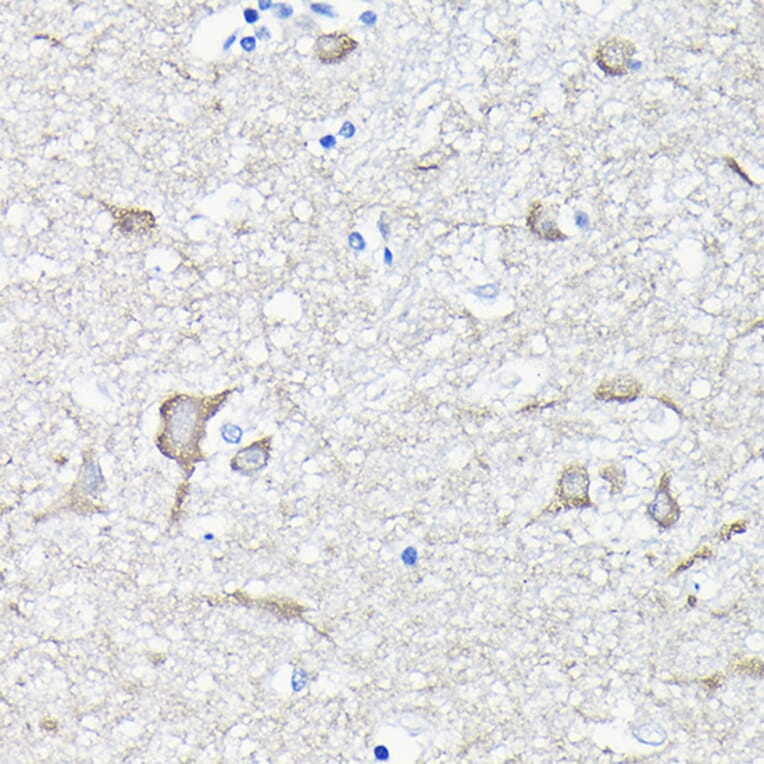 Immunohistochemistry - Anti-EEF1A2 Antibody (A15645) - Antibodies.com
