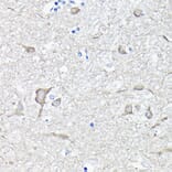 Immunohistochemistry - Anti-EEF1A2 Antibody (A15645) - Antibodies.com