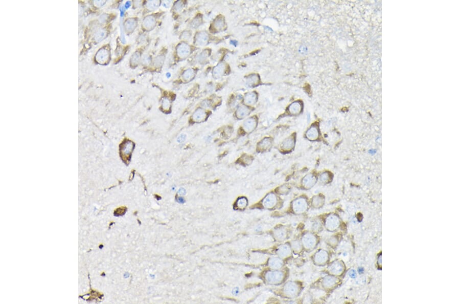Immunohistochemistry - Anti-EEF1A2 Antibody (A15645) - Antibodies.com