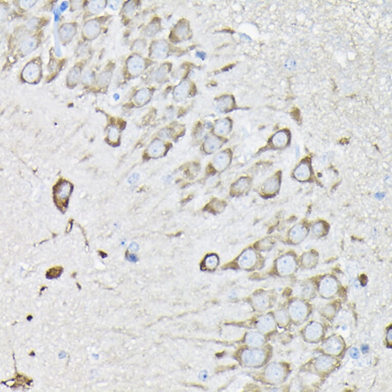 Immunohistochemistry - Anti-EEF1A2 Antibody (A15645) - Antibodies.com