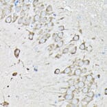 Immunohistochemistry - Anti-EEF1A2 Antibody (A15645) - Antibodies.com