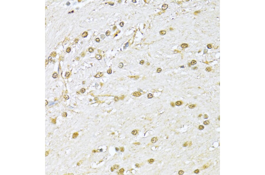 Immunohistochemistry - Anti-Ku70 Antibody (A15646) - Antibodies.com