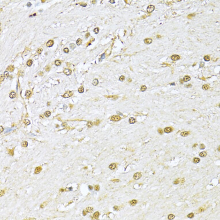 Immunohistochemistry - Anti-Ku70 Antibody (A15646) - Antibodies.com