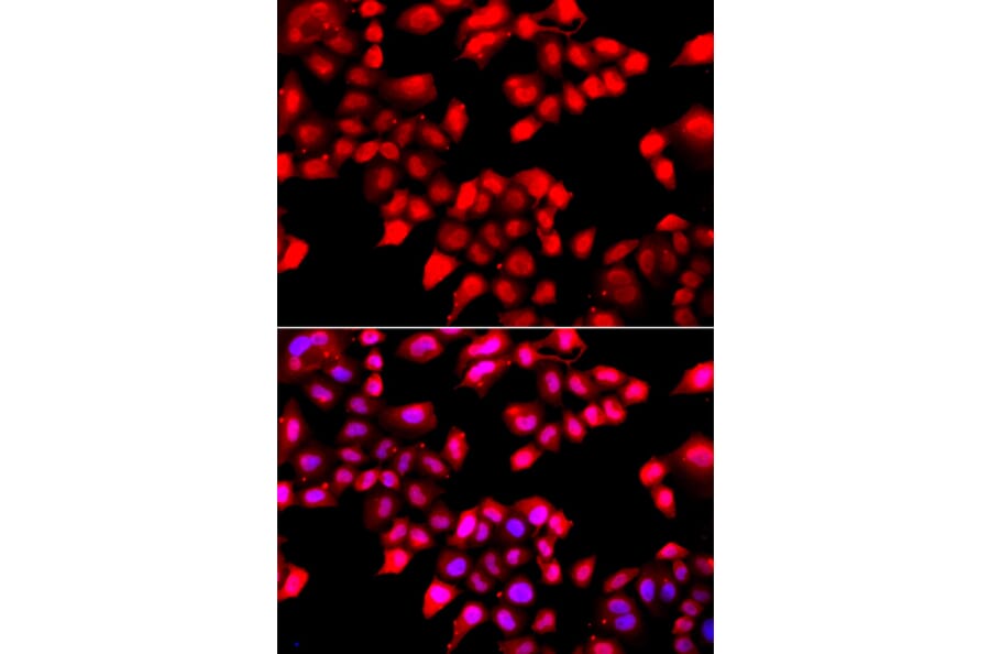 Immunofluorescence - Anti-Ku70 Antibody (A15646) - Antibodies.com