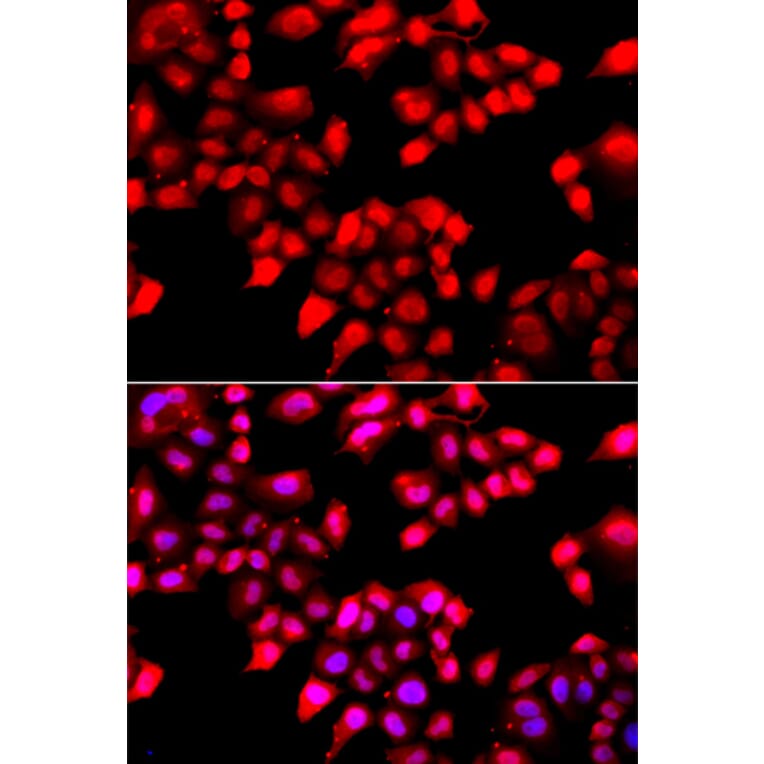 Immunofluorescence - Anti-Ku70 Antibody (A15646) - Antibodies.com