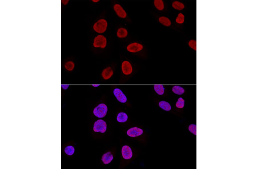 Immunofluorescence - Anti-Ku70 Antibody (A15646) - Antibodies.com