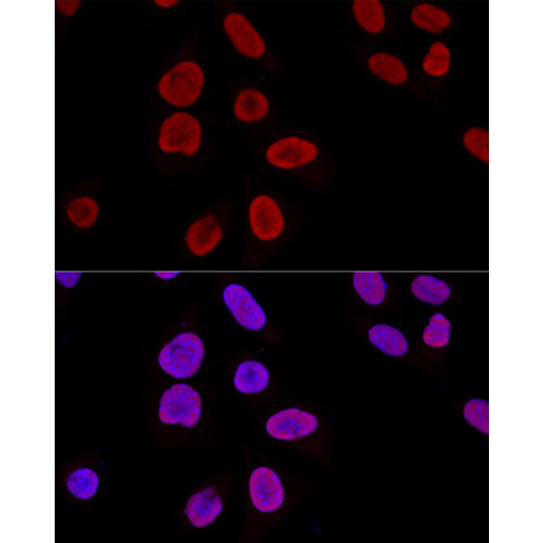 Immunofluorescence - Anti-Ku70 Antibody (A15646) - Antibodies.com