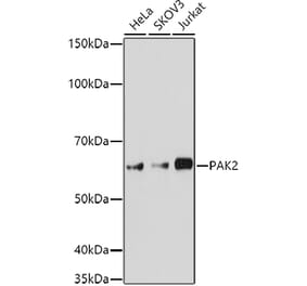 Western Blot - Anti-PAK2 Antibody (A15648) - Antibodies.com