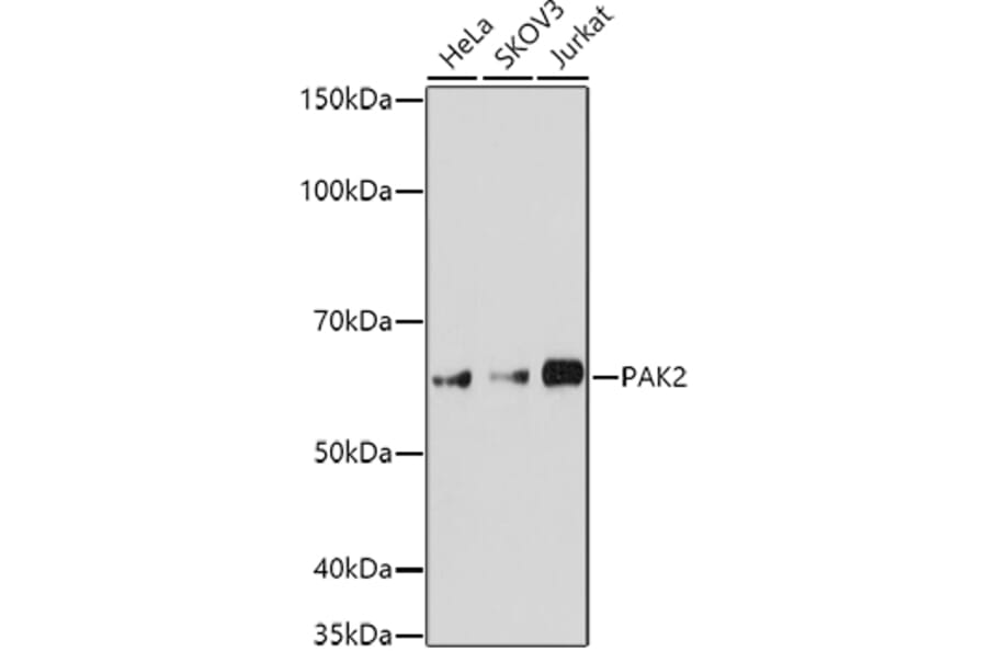 Western Blot - Anti-PAK2 Antibody (A15648) - Antibodies.com