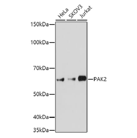 Western Blot - Anti-PAK2 Antibody (A15648) - Antibodies.com