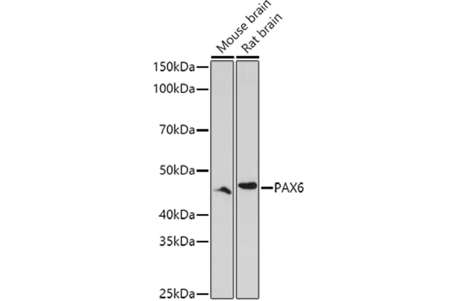 Western Blot - Anti-PAX6 Antibody (A15649) - Antibodies.com