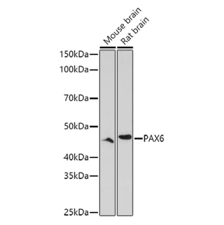 Western Blot - Anti-PAX6 Antibody (A15649) - Antibodies.com