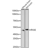 Western Blot - Anti-PAX6 Antibody (A15649) - Antibodies.com