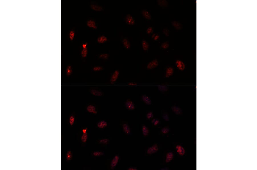 Immunofluorescence - Anti-PAX6 Antibody (A15649) - Antibodies.com