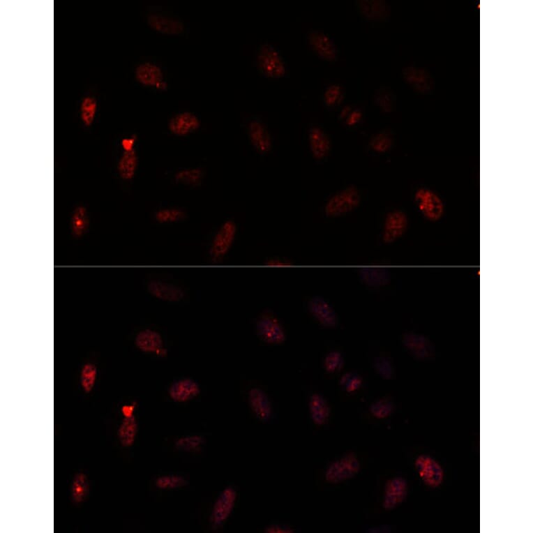 Immunofluorescence - Anti-PAX6 Antibody (A15649) - Antibodies.com