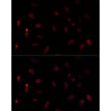 Immunofluorescence - Anti-PAX6 Antibody (A15649) - Antibodies.com